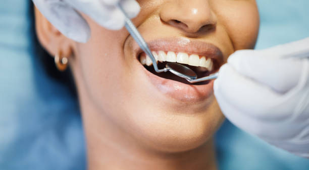 Best Emergency Tooth Extraction in Chandler, IN